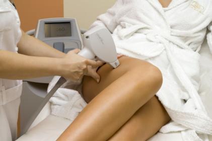 Depilacja Laserowa Nóg