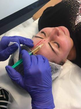 OSOCZE BOGATOPŁYTKOWE