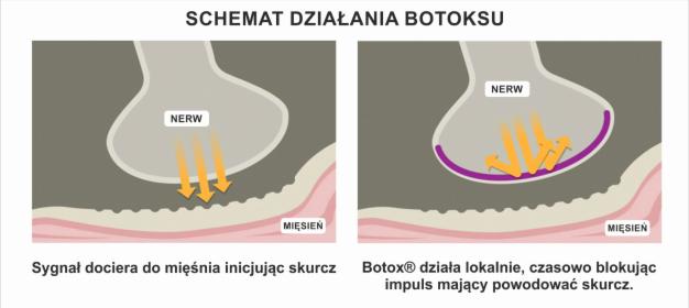 BOTOX toksyna botulinowa