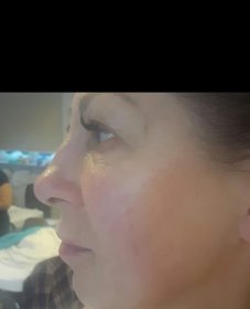 Masaż japoński KOBIDO