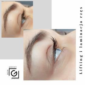 Lifting, botox i laminacja rzęs