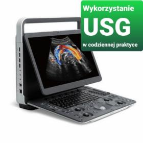 Konsultacja z USG sonofeedback