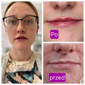 Medycyna estetyczna, zabiegi kosmetologiczne