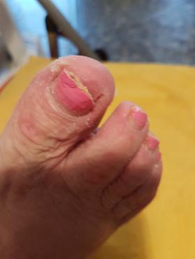 zabiegi na ciało twarz ,stopy