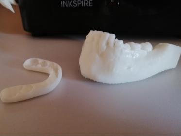Projekt oraz wydruk CAD CAM cyfrowa stomatologia łuk zębowy szczenka proteza CBCT