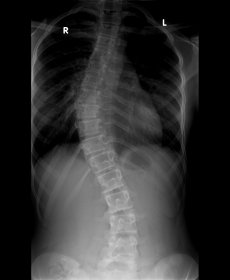 Gimnastyka korekcyjna