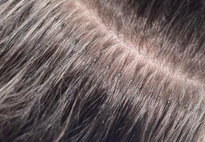 przedłużanie włosów metoda nano/mini oraz zabiegi typu nanoplastia, keratyna, botols,