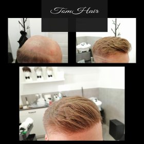 Montaż Włosów Systemowych