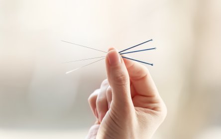 zabieg akupunktury
