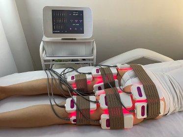 laserowe wyszczuplanie - LipoLaser Xante