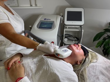 fototerapia 3D IPL - Alpha System