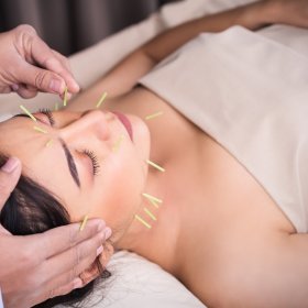 Akupunktura kosmetologiczna - 100 punktów piękności