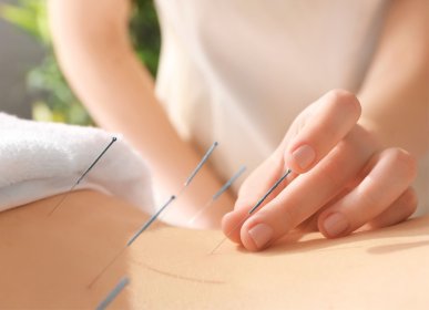 Akupunktura - kolejna wizyta