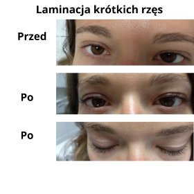 Laminacja rzęs