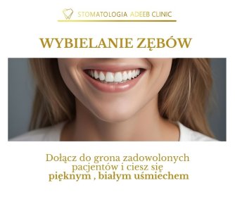 WYBIELANIE ZĘBÓW