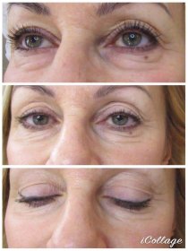 Stymulator peptydowy