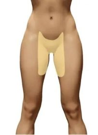 Nadpotliwość pachwin