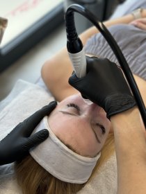 Oczyszczanie wodorowe