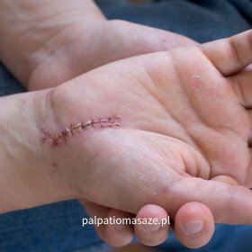Masaż dłoni