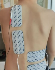 Elektrostymulacja FES