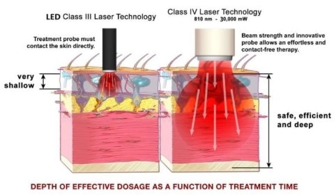 Laser wysokoenergetyczny