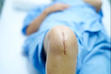 Rehabilitacja kolana barku kręgosłupa po operacji