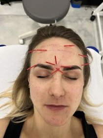 Fizjoterapia estetyczna