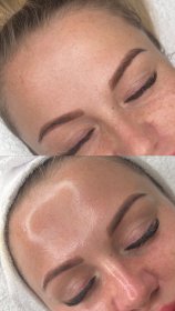 🔹 Zabieg Glass Skin Ustroń