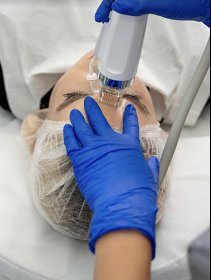 Radiofrekwencja Milroigłowa