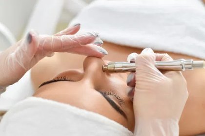 Mikrodermabrazja diamentowa