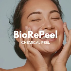 BioRePeel Cl3 dwufazowy peeling medyczny