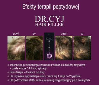 Dr Cyj Hair Filler - leczenie i terapia wypadania włosów