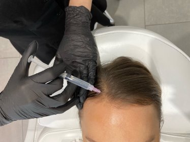 Medycyna estetyczna Kraków – My Body Clinic. Naturalne odmładzanie twarzy.