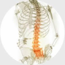Prześwietlenie kręgosłupa z zaznaczonymi na pomarańczowo obszarami, widok z przodu, na białym tle. Diagnostyka medyczna.