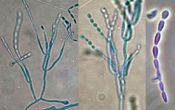 Usuwanie Likwidacja Pleśni Grzyba Zagrzybień Odgrzybianie