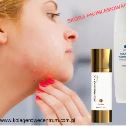 Profil kobiety z nałożonym produktem na skórę twarzy, obok dwa opakowania kosmetyków Colway: Atelomaska na noc i Kolagen Naturalny Platinum. Widoczny zaczerwieniony obszar skóry.