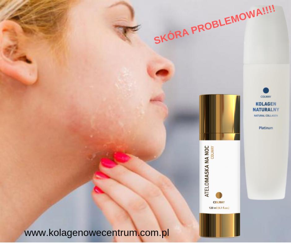 Profil kobiety z nałożonym produktem na skórę twarzy, obok dwa opakowania kosmetyków Colway: Atelomaska na noc i Kolagen Naturalny Platinum. Widoczny zaczerwieniony obszar skóry.
