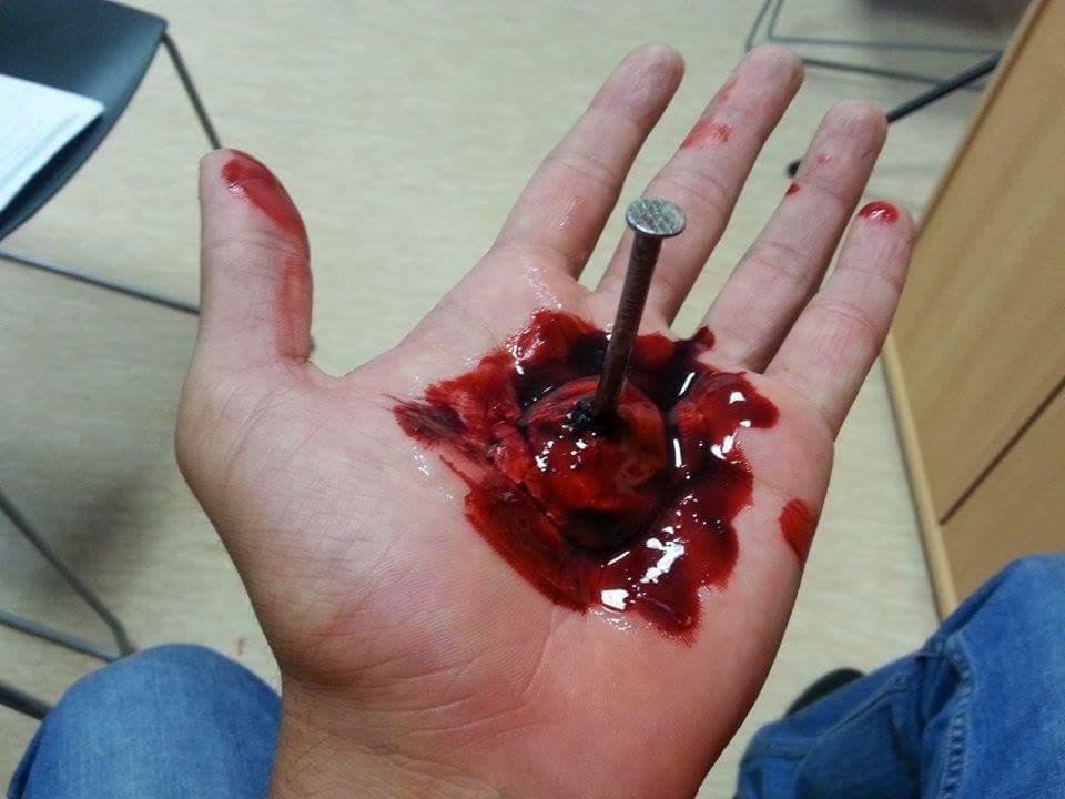 Realistyczna rana dłoni z wbitym gwoździem, używana podczas symulacji urazów na kursie pierwszej pomocy. Krew i sztuczne uszkodzenia skóry.