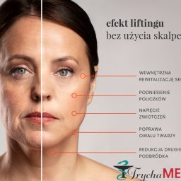 Zabieg Hifu przeznaczony jest do poprawy gęstości skóry twarzy i ciała, redukcji zmarszczek, liftingu oraz odmłodzenia skóry.

