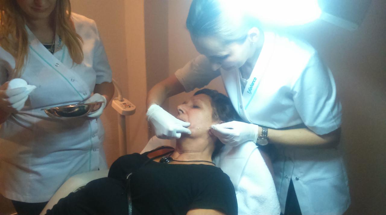 Lekarz w białym uniformie wykonuje zabieg z użyciem nici na twarzy pacjentki leżącej na fotelu; asystentka trzyma miseczkę z wacikami; widoczna lampa zabiegowa.