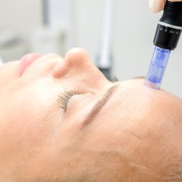 Gabinet Kosmetyczny oraz Studio Wizażu i Charakteryzacji Estetica - Dermapen, mezoterapia mikroigłowa skóry, mikronakłuwanie skóry