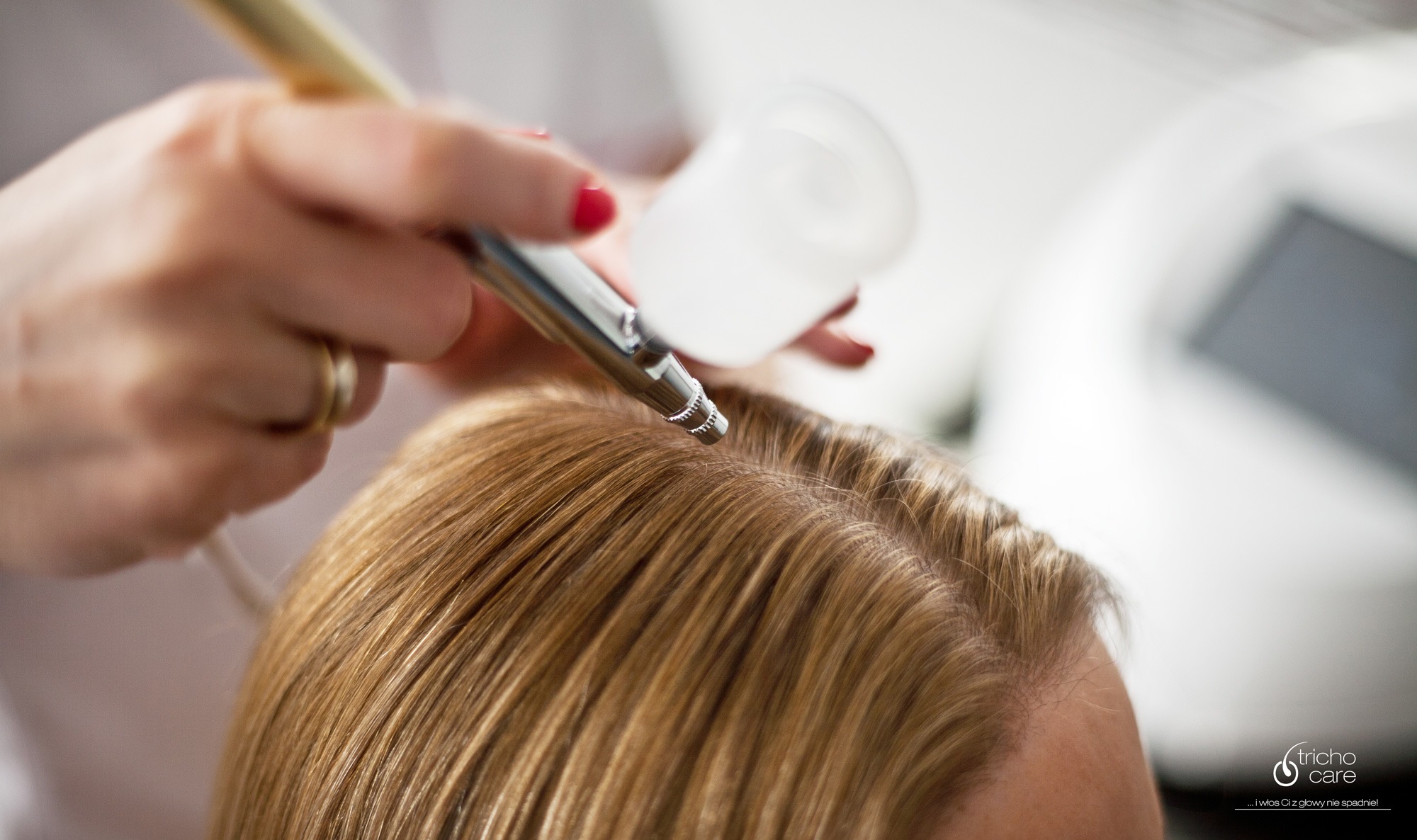 Infuzja tlenowa skóry głowy