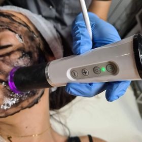 Zabieg na twarz z użyciem urządzenia Geneo: aplikacja preparatu z węglem aktywnym i działanie głowicą z fioletowym światłem. Widoczne niebieskie rękawice kosmetyczki.