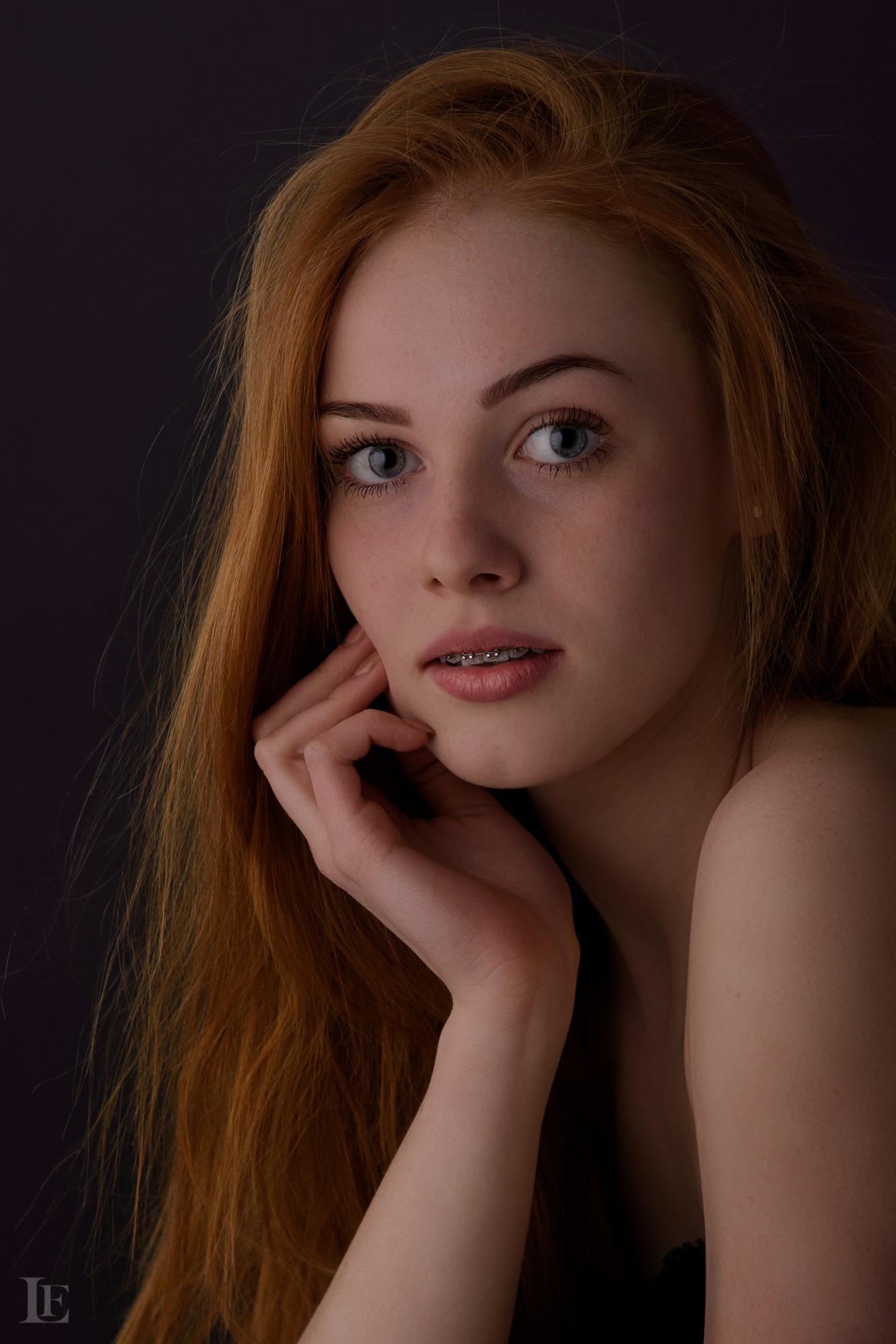 Portret młodej kobiety o rudych włosach i niebieskich oczach, z aparatem ortodontycznym na zębach, delikatnie dotykającej twarzy dłonią na ciemnym tle.