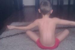 Rehabilitacja skoliozy