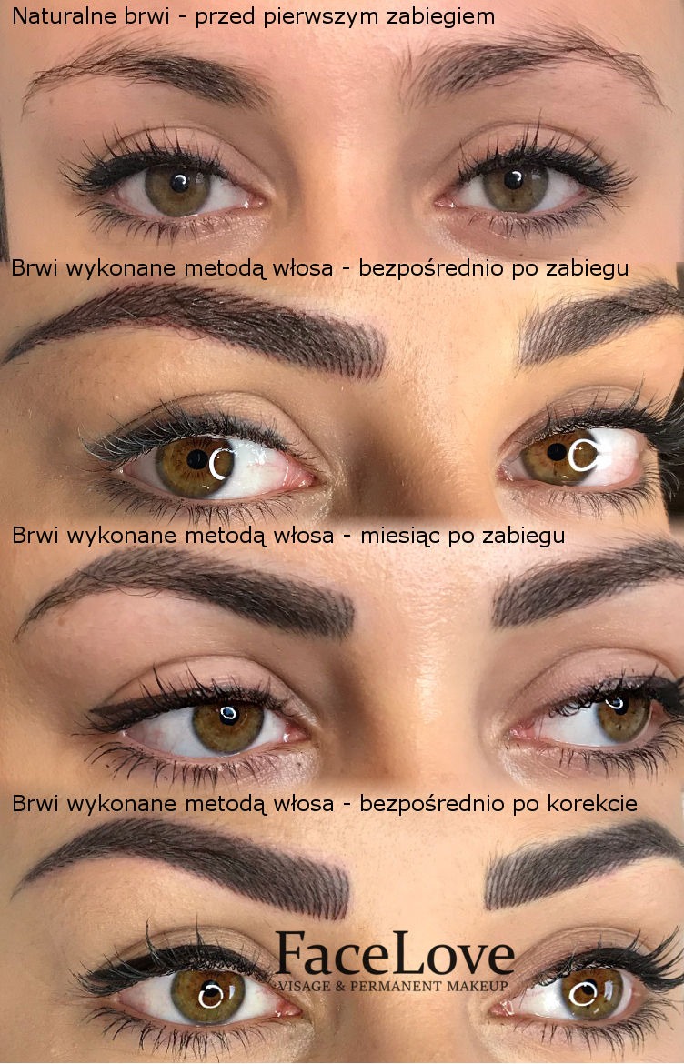 Zdjęcie przedstawia ewolucję brwi po zabiegu mikropigmentacji: naturalne brwi przed zabiegiem, brwi wykonane metodą włosa bezpośrednio po zabiegu, miesiąc po zabiegu oraz bezpośrednio po korekcie...