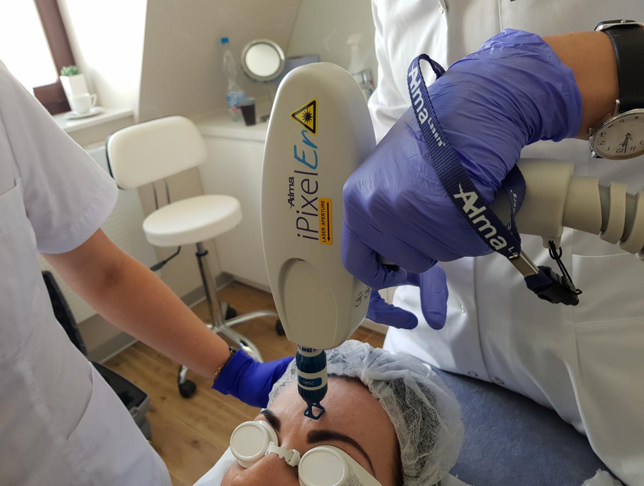 Zabieg laserowy na twarzy pacjentki w ochronnych okularach, wykonywany urządzeniem Alma iPixel Er w gabinecie medycyny estetycznej w Tarnobrzegu.