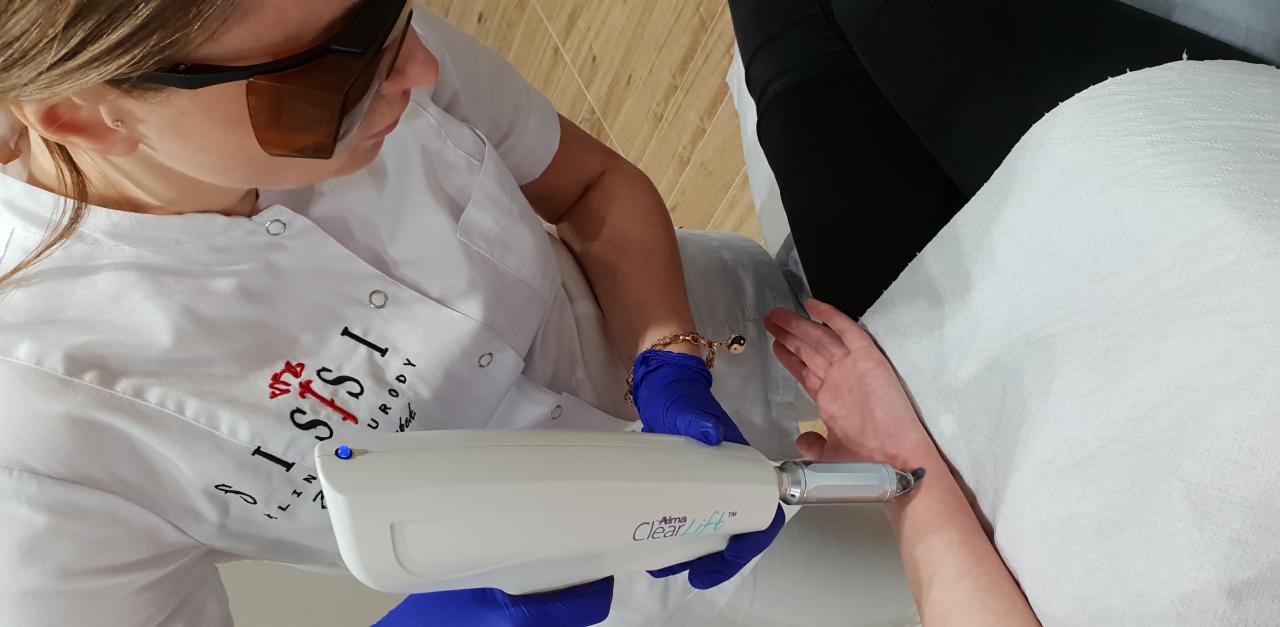 Zabieg laserowy ClearLift na skórze przedramienia wykonywany przez specjalistę w okularach ochronnych i niebieskich rękawicach, widoczne logo gabinetu na białym uniformie.