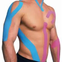 Kinezjotaping