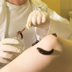 Fizjoterapeuta Ostrów Wielkopolski 2